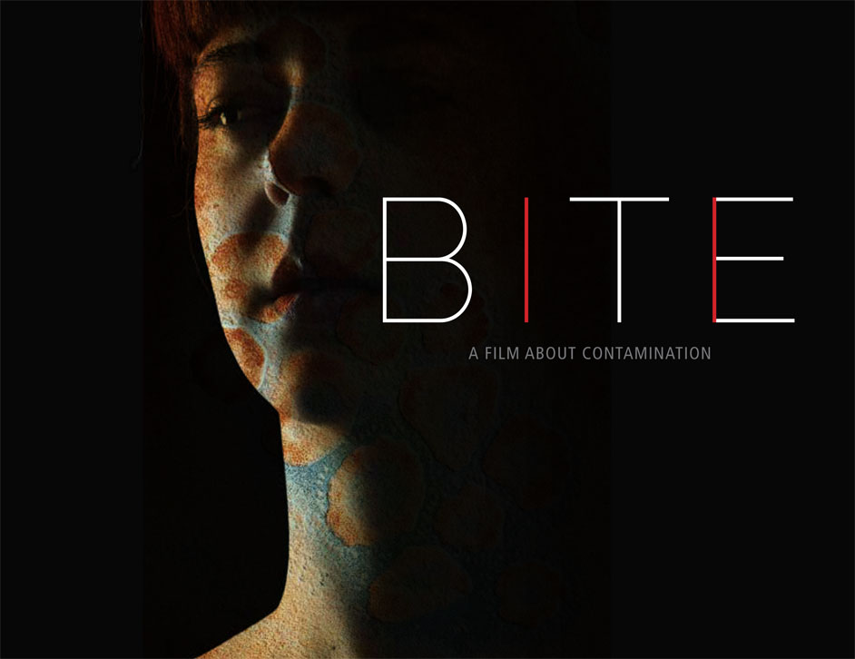 Photo of bite-poster